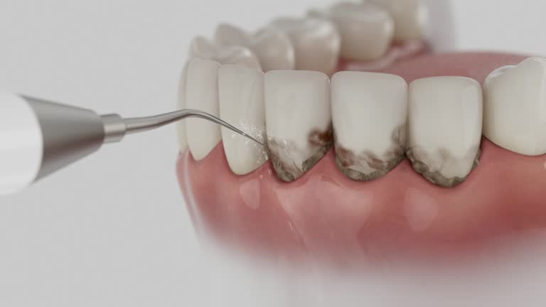 Trusted Tooth Extraction service in Fletcher, NC - Dentist Open Now